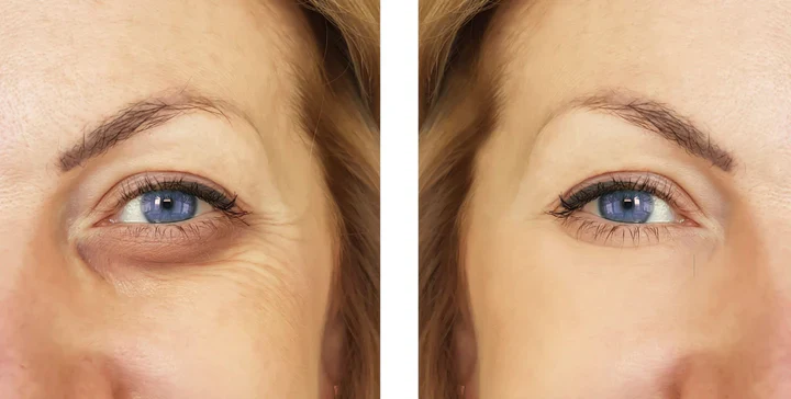 Intense Eye Revive - Special Offer - Image 5