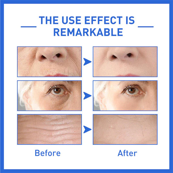 Last Day Promotion 70% OFF - 🔥2023 New Collagen Boost Permanent  Anti-Aging Serum - Image 12